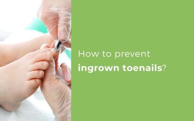 How to prevent ingrown toenails?